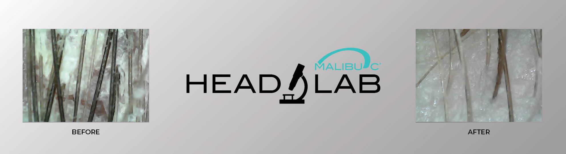 Malibu C Head Lab Services 2025